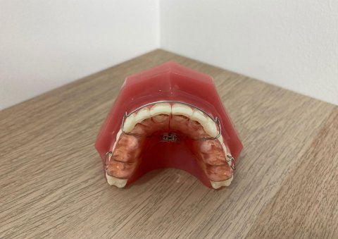 plaat-met-expansieschroef-orthopraktijk-capelle